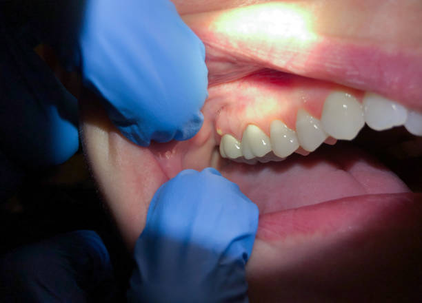 Best Tooth Pain Emergency Relief  in Lyndonville, VT
