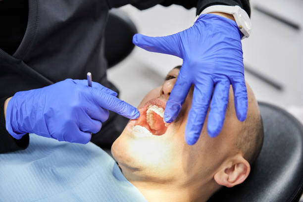 Best Dentist for Severe Toothache  in Lyndonville, VT