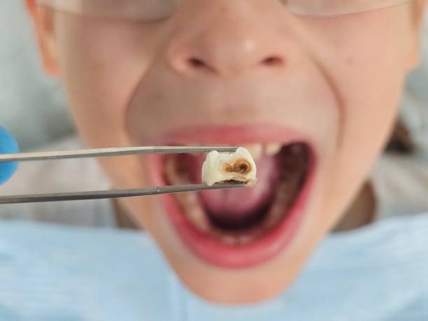 Professional Emergency Dentist in VT